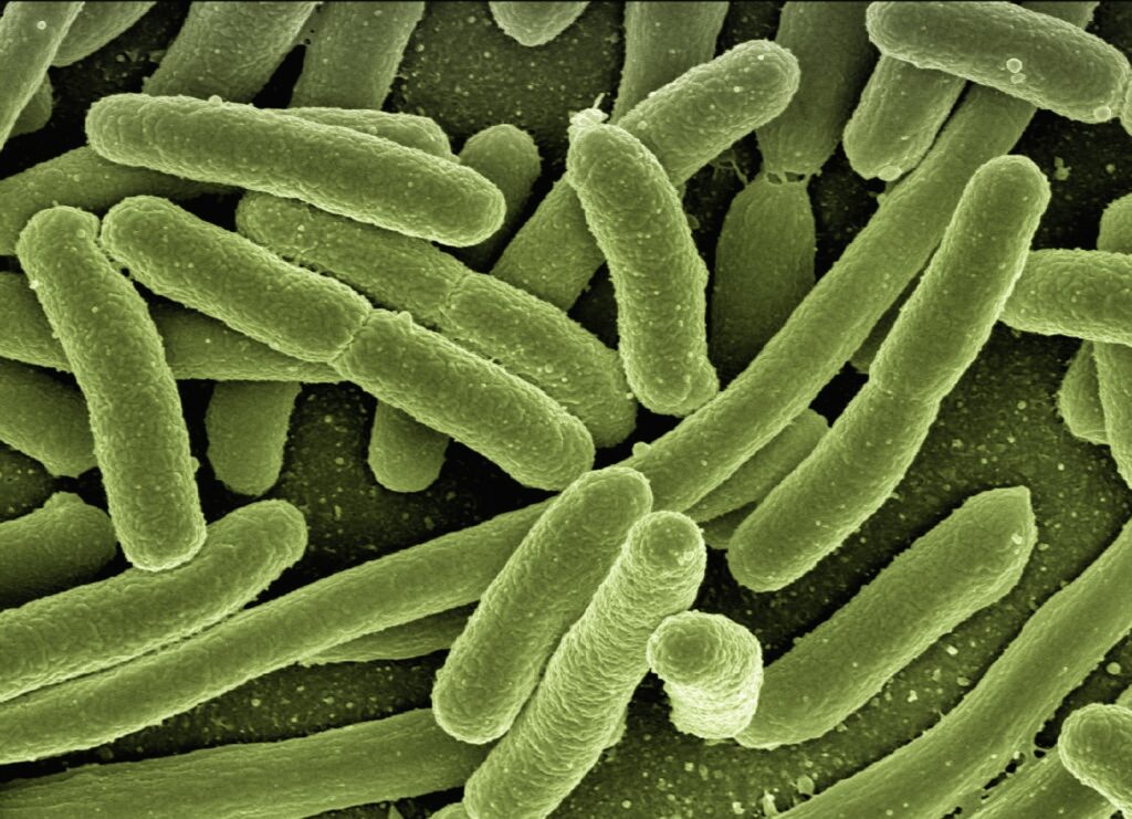 Bacterial infection can cause green poop