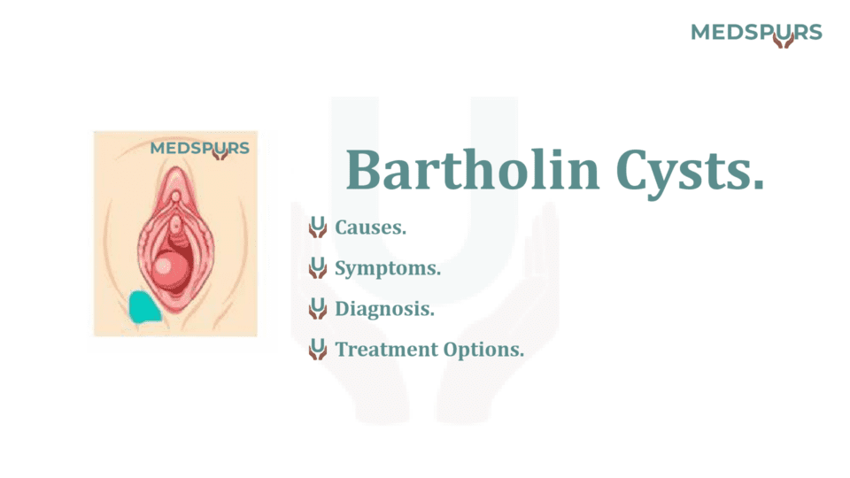 Bartholin Cysts Causes Treatment And Questions In 2023 Medspurs 6251