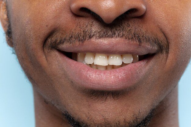 A man after tooth scaling and root planing procedure 